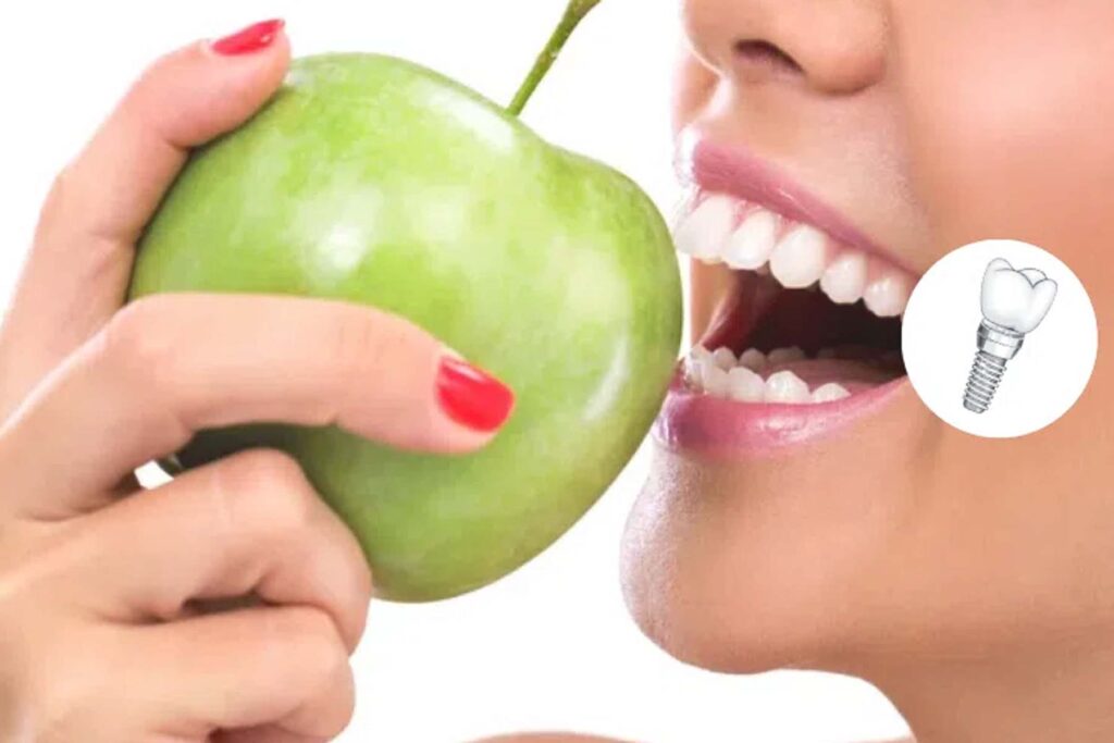 Tips for Eating with Dental Implants